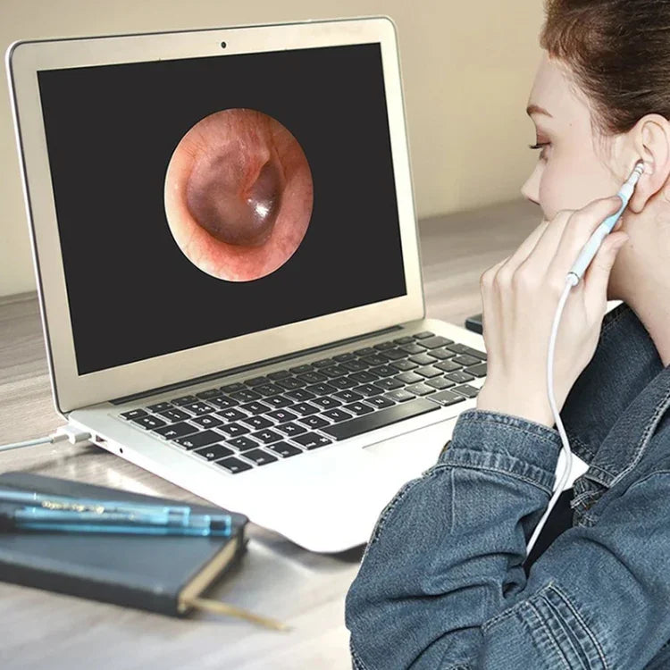 i95 3 in 1 USB Ear Scope Inspection HD 0.3MP Camera Visual Ear Spoon for OTG Android Phones & PC & MacBook, 1.75m Length Cable, 3 in 1 White  0.3MP