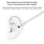 Supereyes Y001 Ear Mite Mouth Electronic Digital Fixed Focus Endoscope, Y001