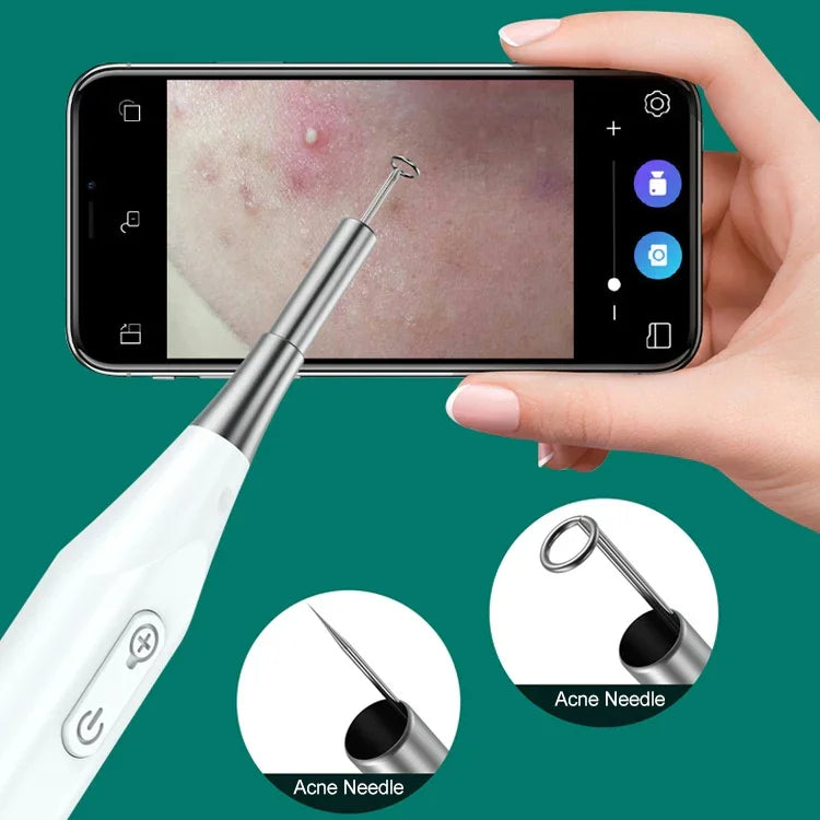 Supereyes Y009 Visual Ear Pick Acne Cleaning Microscopic Magnifying Mirror Endoscope, Y009
