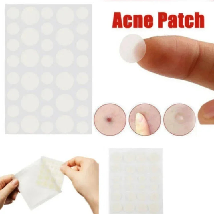 3 PCS Acne Tool Set Treatment Acne Scar  Pimples Sticker